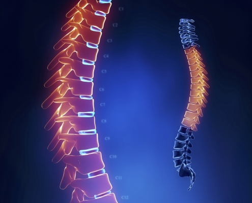 Orthofix Spinal Products
